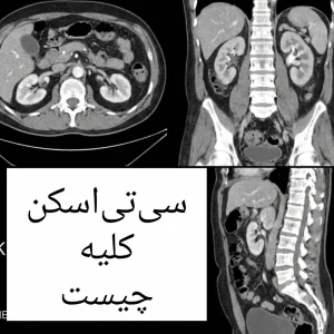 سی‌تی‌اسکن کلیه چیست و چه کاربردی دارد؟