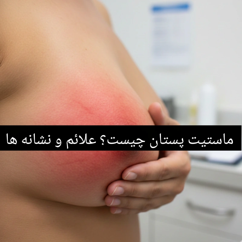 با علائم و نشانه های ماستیت پستان آشنا شوید